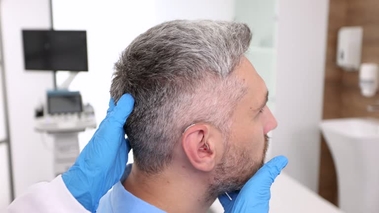 Odwrócenie wypadania włosów: fakt czy mit? Przyczyny, opcje i kiedy do kliniki
