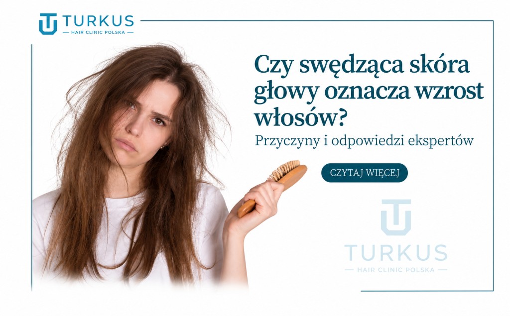 Ilustracja artykułu: Czy swędząca skóra głowy oznacza wzrost włosów? Przyczyny i odpowiedzi ekspertów