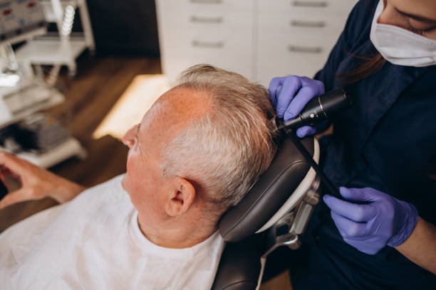 Przeszczep FUE, naturalna linia włosów i plan graftów w Turkus Hair Transplant Clinic.