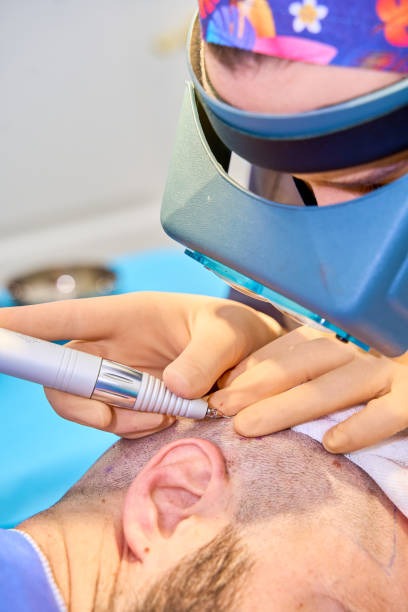Lekarz omawia plan przeszczepu włosów podczas bezpłatnej konsultacji w Turkus Hair Transplant Clinic, Warszawa.