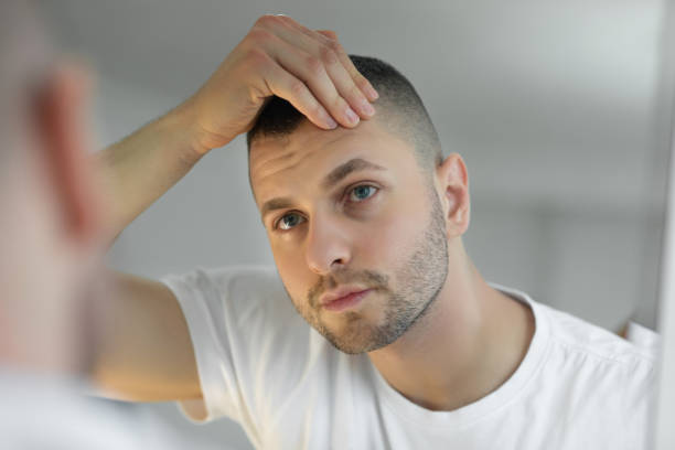 Konsultacja pacjenta w sprawie przyczyn wypadania włosów w Turkus Hair Transplant Clinic, Warszawa.