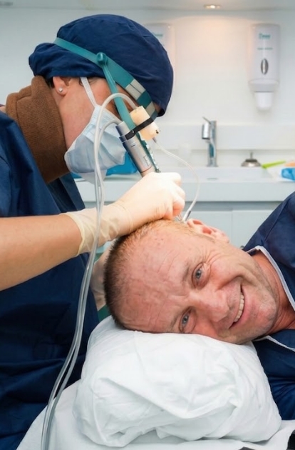 Turkus Hair Transplant Clinic, przeszczep bez golenia w Polsce.